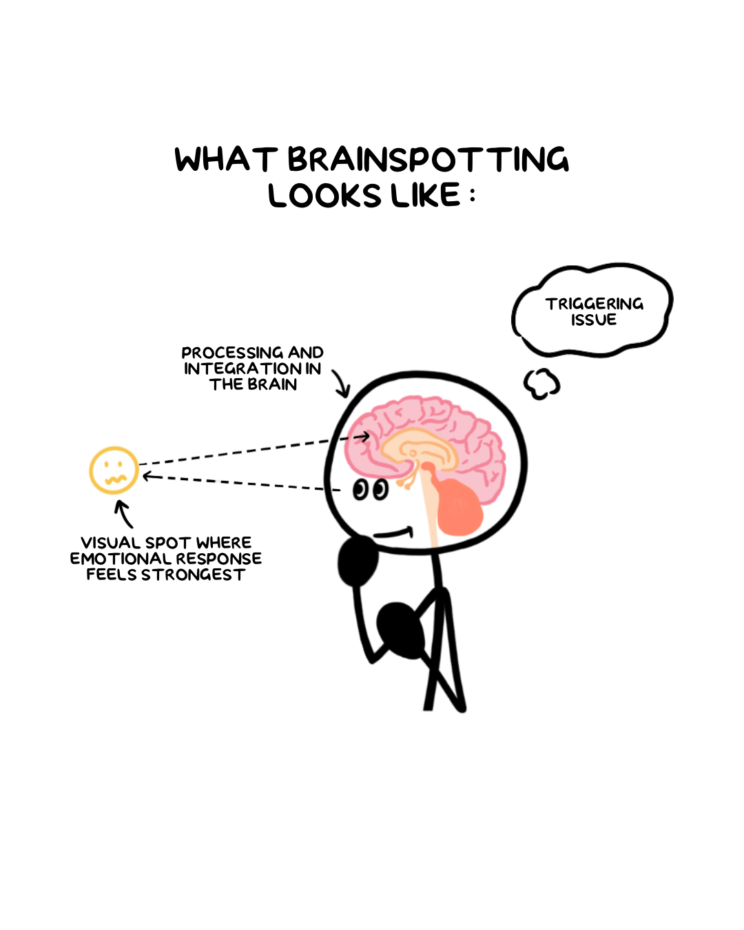 Brainspotting, illustrated